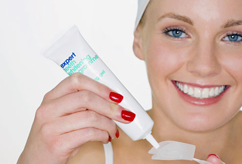 Get a Celebrity White Smile | Teeth Whitening Rohner Park